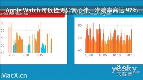 %准确率 三星手表系统全球第二MG电子模拟器苹果表心率97(图2)